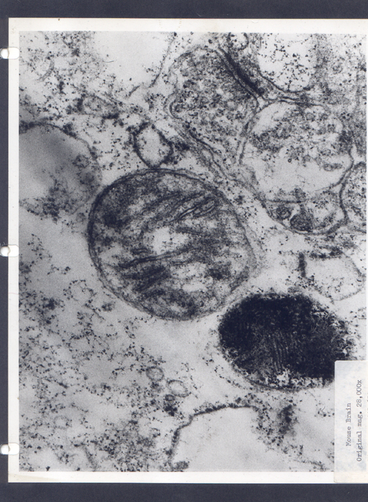 mouse-brain2.jpg